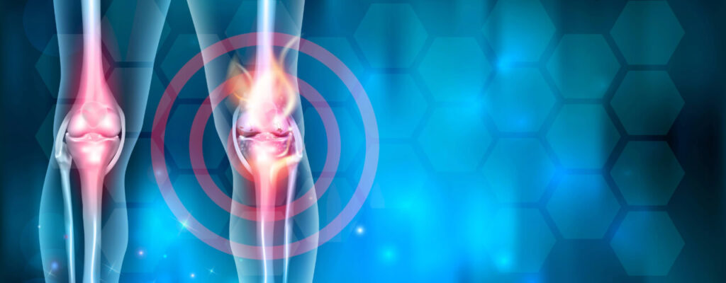 Accelerating ACL Surgery Recovery